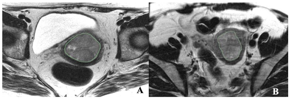 Fig1